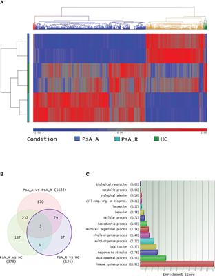 Molecular profiling of clinical remission in psoriatic arthritis reveals dysregulation of FOS and CCDC50 genes: a gene expression study